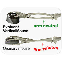 Evoluent VerticalMouse D